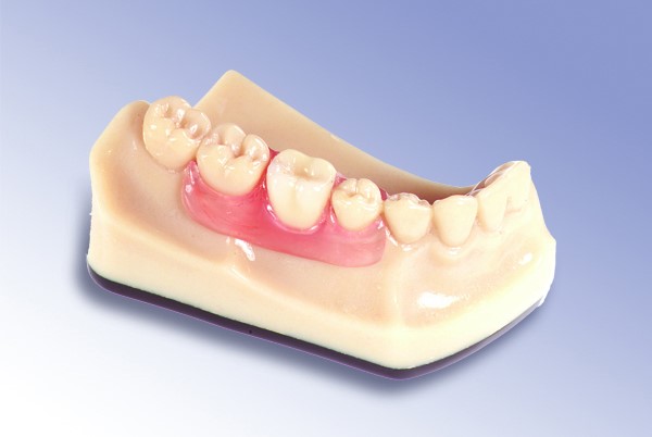 Complete Dentures Albany VT 5820